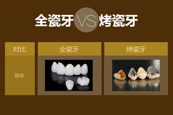 贵金属缺点(贵金属优缺点)