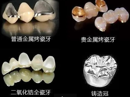 贵金属缺点(贵金属好不好)